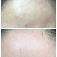 ��ҩ��Ĥ��Ĥ�ۡ��ȥ����ҩ��Ĥ