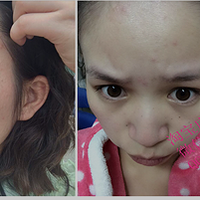 ��ҩ��Ĥ�� �Ŷ����������ҩ��Ĥ