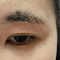 ͨ��üë�ı����ʣ����˰���