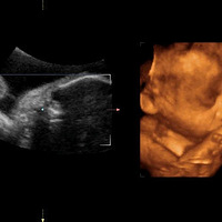 ˵˵������ά�ʳ��ľ���