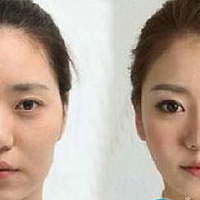 �������ζԱ�ͼ