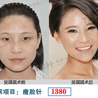 ��������Ը����ʵ����ô��˵���������Ը����ʱ������Բ�Σ���