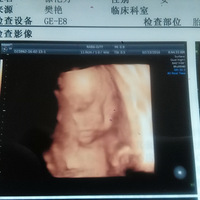 ��߶�ϰֵ��弾