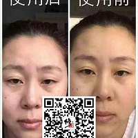 ���������ף�������ױر�������