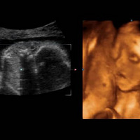 ��24���ĵ���ά�ʳ�,�ʹ�ҷ���Ŷ