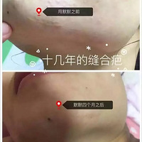 ����̺ۡ�ʮ����ķ�ϰ̺ۣ��ĸ��£��Ѿ���ȫ�޸��ˡ�