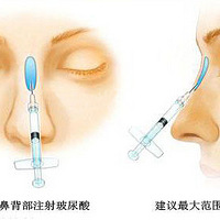 ʱ��̷�ո�Ժ�������μӡ�����gogogo����Ŀ�ҿ�����������Ŀ