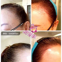 �绨�ң�51�151Ԫ����ʽ��������ͫ����