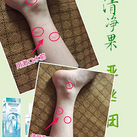 我太聪明了，以后出去山里玩再也不怕蚊子咬