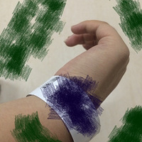 �����˺Ͳ��쾭��+�ߴ��ϵģ�ûӵ���Ĳ��쾭��