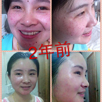 ����˿�������������ߵ�����1�����ࣺ��