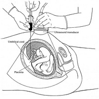 ��ˮ���̷���  ��ֻ��������һ����ô��