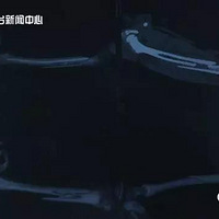 7���к����ȱ�ͬѧ���ϣ�������һ��С��Ϸ���ܶຢ�Ӷ�ϲ��