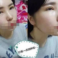 û�뵽˫��Ƥһ�ָܻ���ô��Ȼ������