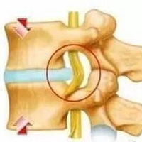 Ԥ����ͻ֢������4������