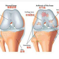 ȫ���令ϥ�ֲ�