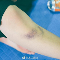 Ů�Ӹ񶷣�������ʹֻ���ճ�