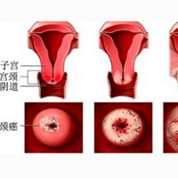 ��ҽ����룺����3�־�����Ů�ԣ���ò�鹬�������ܾ�����