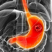 ���ڰ�֢��ʵ��������ֻԹ���ûע�����Щ�����źţ�