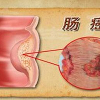 ��������ɱ������������Ů���ʼ����������ڣ�