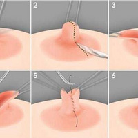 ��������10���쳣�仯����֢�Ѿ���Ȼ��Ϯ��