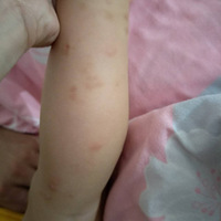 �����������߼��� ��27�����б����ϳ��˺�㣬ҽ��˵û�취��