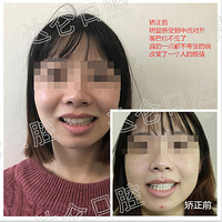 �����ĸ����������� ŷ����������ר���Ŷ�