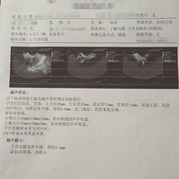 ԭ��300Ԫ����B�����Ѽ��69Ԫ�ؼ۹� �������ѣ�ӭ�Ӻ��У�