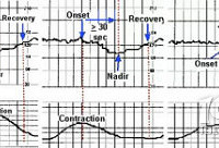 ̥�Ŀ���ô�죿̥��Խ��Խ������ô���£�