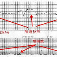 39��̥�ļ໤����ô�죿��̥ͥ�ļ໤��ô����