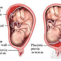 ����7����̥�̵��ϳ�Ѫ��ô�죿̥�̵��ϳ�Ѫ����ôһ���£�