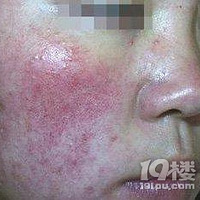 ����������Ƥ�ף��Ǹ�ʲô����ԭ����ô���£�����