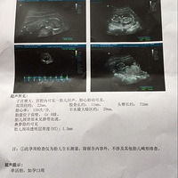 ����Ů� �������ֹ� �����˹�Ȼ������