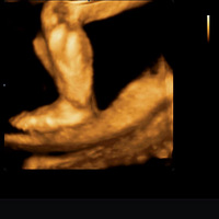 �����ά�ʳ�����