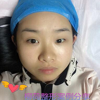 п˫Ƥָʱ  &%  п˫Ƥ۸