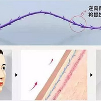 ��������ҽԺ�ߵ���ô�������ʺ��ô�V�߻���СV�ߣ�