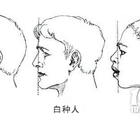 龅牙凸嘴怎么办？