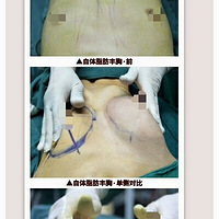 ר��Ũ��֬�����ص�Ч��