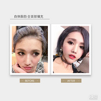 Ũ��֬���沿����ܴﵽʲô����Ч����