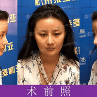 ʱ�д���Yumi�ú���ά���������������沿����