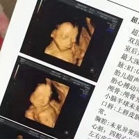 ����άVS��������ά������Ҽҷ���