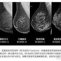 �ۺ�ʮ�� ����ɸ�� ����ͬ��һ���ⵥ����