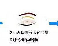 һ���ӿ���˫��Ƥ������