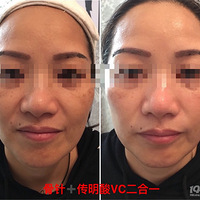 һ������5��10������ܣ��¹��޴���Ƥ�����˻���ԤԼ