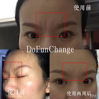 ȫ���Ҽ�����ˮ�ķ���ͼ��������ʵ��Ч����