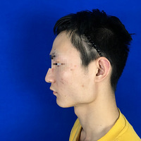 ���������ָ�Ҫ�೤ʱ�䣿