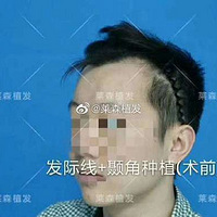 ��ɭֲ����������ֲ������һ�꣬Ч�������գ�