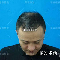 �����弶����ɭֲ��ʮ���º�ӭ����Υ���ഺ~