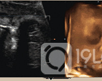 ����ά�ʳ����ͱ����ĵ�һ��Լ�ᣬ��¼����ĸж�