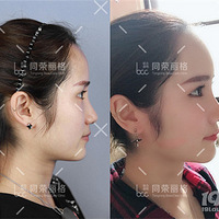 ��ͬ�ٰ�����������Ȼ���˵ġ�����ɱ������ֻ���ű��ӿ�